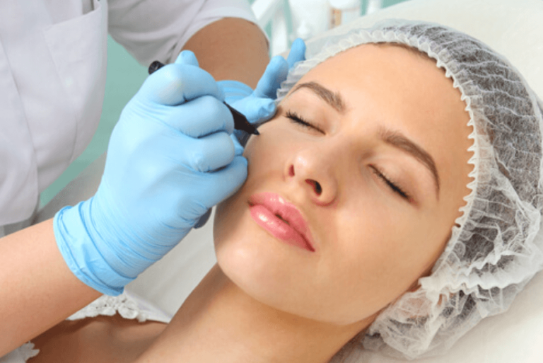 Avoid Scarring After Blepharoplasty Surgery with Proper Care