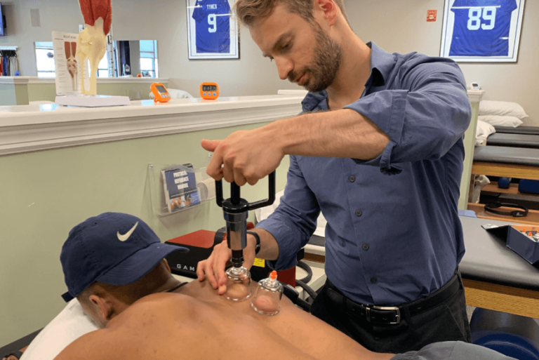 7 Surprising Myths About Cupping Therapy in Montreal, QC