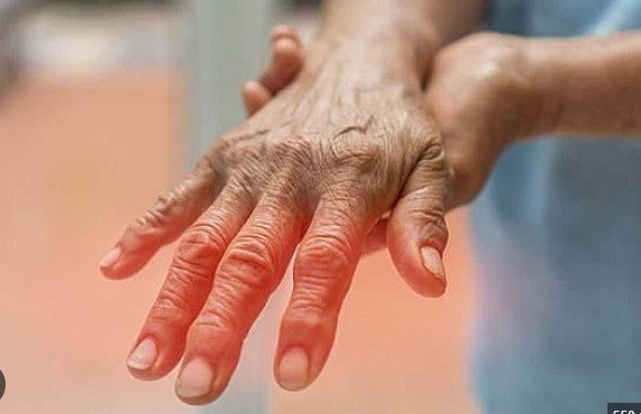 Peripheral neuropathy